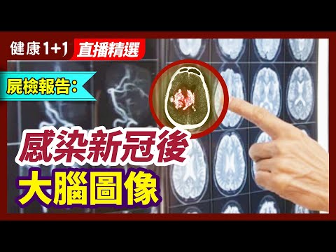 私密：[ID: kMSdBqhGDJM] Youtube Automatic